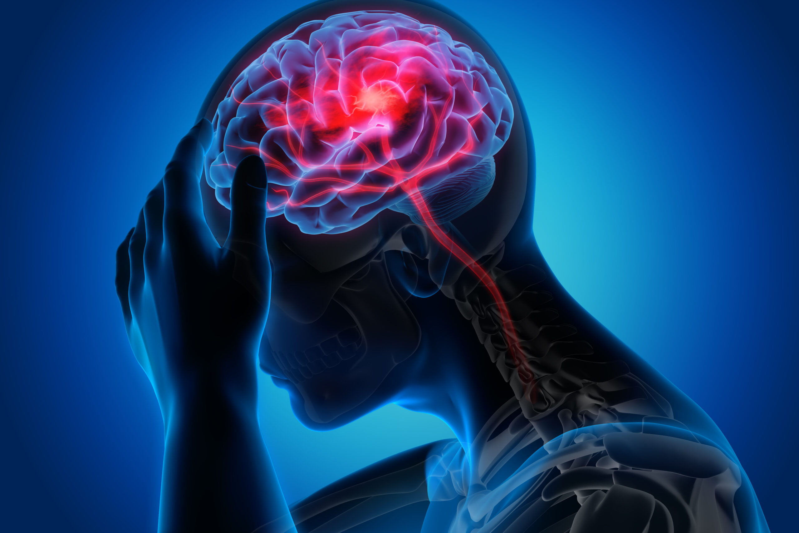 Neurological Conditions