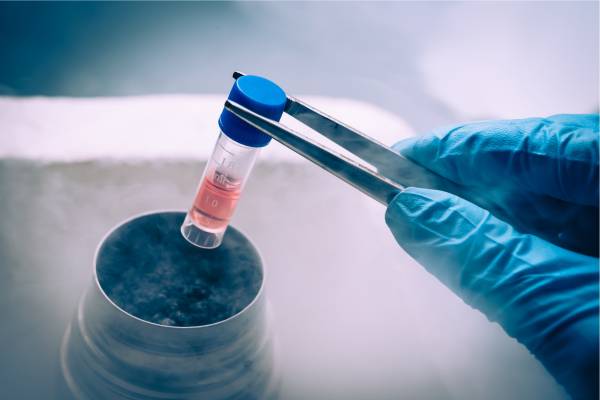 Extracting stem cells from the umbilical cord