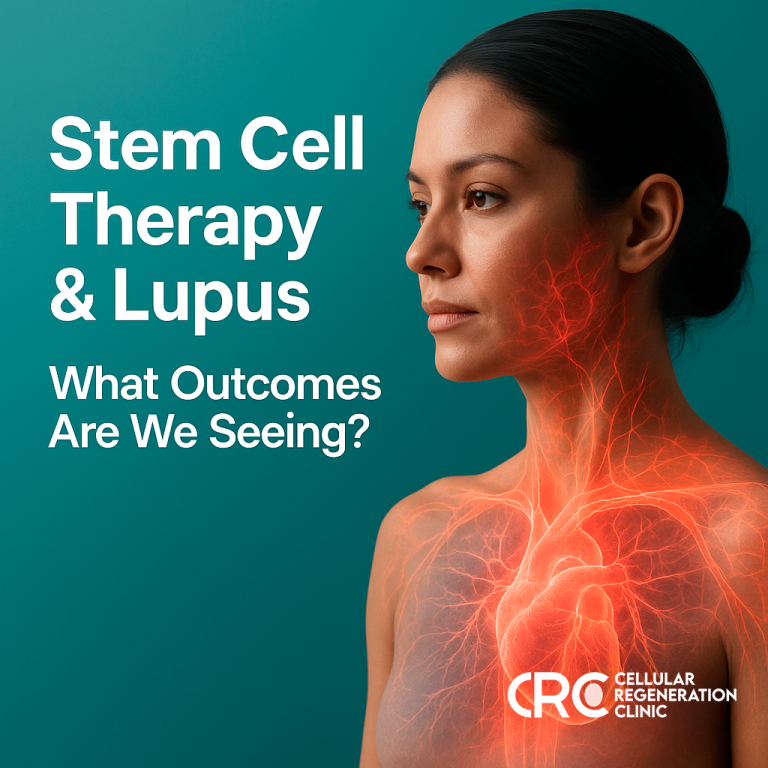 Realistic image of a woman with lupus inflammation illustration, promoting stem cell therapy benefits at CRC