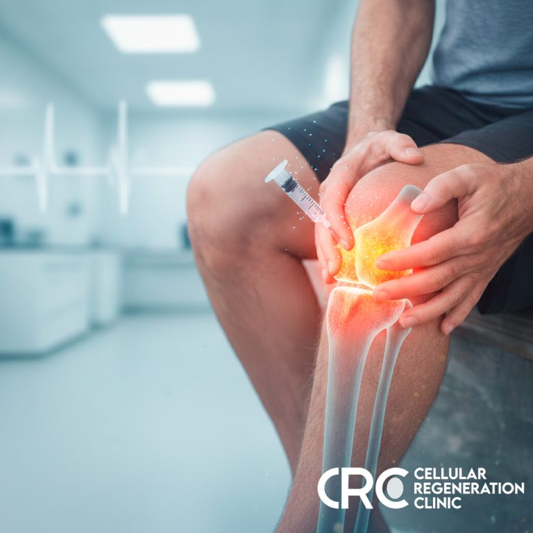 Comparación de rodilla sana vs rodilla con artrosis tratada con células madre