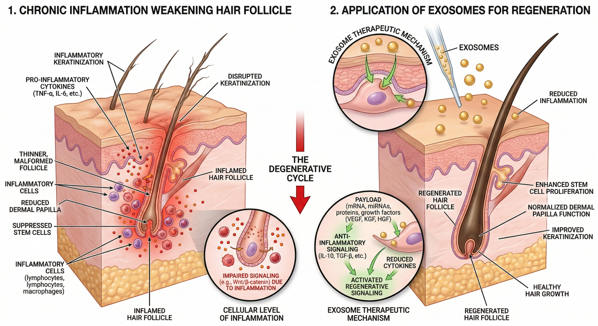 Reactivating Dormant Follicles: The Science of Cellular Hair ...